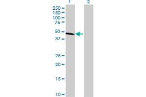 Western Blot analysis of ALDH9A1 expression in transfected 293T cell line by ALDH9A1 MaxPab polyclonal antibody.