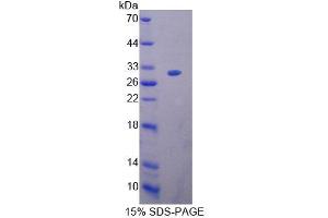 SDS-PAGE analysis of Human BAG1 Protein.