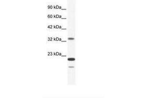 Image no. 1 for anti-Zinc Finger Protein 688 (ZNF688) (AA 95-144) antibody (ABIN203041) (ZNF688 Antikörper  (AA 95-144))