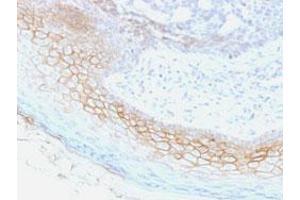 Immunohistochemical staining (Formalin-fixed paraffin-embedded sections) of human skin with DSC2/DSC3 monoclonal antibody, clone 7G6 . (Desmocollin 2 Antikörper  (Extracellular Domain))