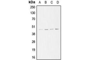 Western blot analysis of ARP3 expression in A549 (A), Jurkat (B), HeLa (C), A431 (D) whole cell lysates. (ANGPTL6 Antikörper  (C-Term))