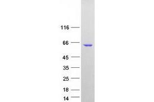 Western Blotting (WB) image for Interferon Regulatory Factor 5 (IRF5) (Transcript Variant 6) protein (Myc-DYKDDDDK Tag) (ABIN2723802)