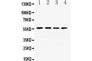 Western blot analysis of Angiotensinogen expression in mouse liver extract ( Lane 1), mouse spleen extract ( Lane 2), mouse testis extract ( Lane 3) and mouse kidney extract ( Lane 4).