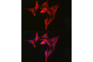 Immunofluorescence analysis of NIH-3T3 cells using α-Tubulin Mouse mAb (ABIN7271035) at dilution of 1:100 (40x lens). (TUBA4A Antikörper)