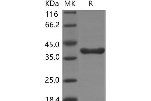 Liver Arginase Protein (MYC tag,His tag)