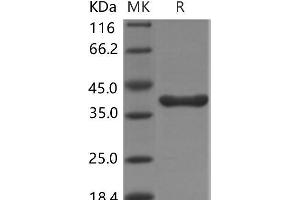 Western Blotting (WB) image for Arginase, Liver (ARG1) protein (MYC tag,His tag) (ABIN7317033) (Liver Arginase Protein (MYC tag,His tag))