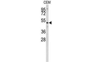 Western blot analysis of CNDP1 Antibody (C-term) in CEM cell line lysates (35µg/lane). (CNDP1 Antikörper  (C-Term))