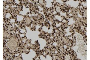 ABIN6266069 and ABIN6277116 at 1/100 staining Rat lung tissue by IHC-P.