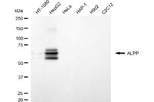 Western blotting analysis using ALPP antibody (ABIN7799843). (Rekombinanter PLAP Antikörper)
