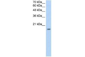 WB Suggested Anti-ZNF580 Antibody Titration:  0. (ZNF580 Antikörper  (N-Term))