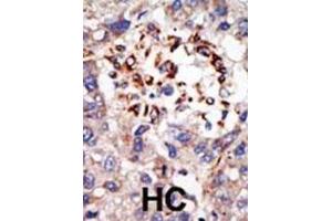Immunohistochemistry (IHC) image for anti-Chromobox Homolog 8 (CBX8) antibody (ABIN3001538) (CBX8 Antikörper)
