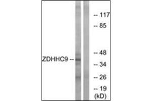 Western blot analysis of extracts from COLO cells, using ZDHHC9 Antibody .