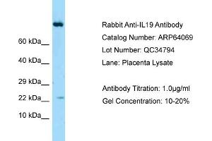 Western Blotting (WB) image for anti-Interleukin 19 (IL19) (Middle Region) antibody (ABIN2789718) (IL-19 Antikörper  (Middle Region))