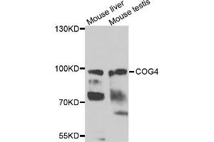 Western blot analysis of extracts of mouse liver and mouse testis cells, using COG4 antibody. (COG4 Antikörper)