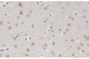 Immunohistochemistry of paraffin-embedded Rat brain using SNRNP70 Polyclonal Antibody at dilution of 1:100 (40x lens).