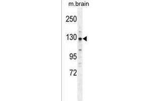 CYLN2 Antibody (C-term) (ABIN1537648 and ABIN2849319) western blot analysis in mouse brain tissue lysates (35 μg/lane). (CLIP2 Antikörper  (C-Term))