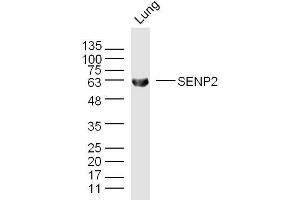 Mouse lung lysates probed with SENP2 Polyclonal Antibody, unconjugated  at 1:300 overnight at 4°C followed by a conjugated secondary antibody for 60 minutes at 37°C. (SENP2 Antikörper  (AA 1-100))