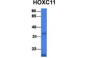 Host:  Rabbit  Target Name:  HOXC11  Sample Type:  721_B  Antibody Dilution:  1. (HOXC11 Antikörper  (Middle Region))
