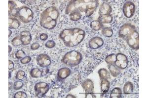 Image no. 2 for anti-Oxidative-Stress Responsive 1 (OXSR1) (AA 1-528) antibody (ABIN599107) (OXSR1 Antikörper  (AA 1-528))