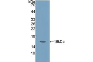 Detection of Recombinant ProGRP, Human using Polyclonal Antibody to Pro-Gastrin Releasing Peptide (ProGRP) (ProGRP Antikörper  (AA 54-148))