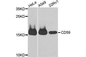 Western blot analysis of extracts of various cell lines, using CD59 antibody. (CD59 Antikörper)