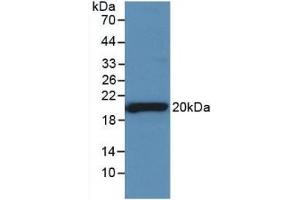 Detection of Recombinant SHBG, Rat using Monoclonal Antibody to Sex Hormone Binding Globulin (SHBG) (SHBG Antikörper  (AA 222-358))