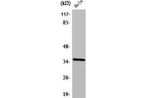 Western Blot analysis of HeLa cells using ZIS Polyclonal Antibody (ZNF265 Antikörper  (Internal Region))