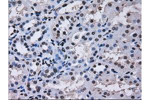 Image no. 5 for anti-Replication Protein A2, 32kDa (RPA2) antibody (ABIN1500735)