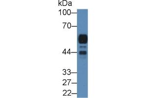 Detection of AMY2A in Rat Pancreas lysate using Polyclonal Antibody to Amylase, Alpha 2A (AMY2A)