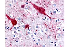 Anti-SLC5A9 antibody IHC of human brain, cortex. (SLC5A9 Antikörper  (C-Term))