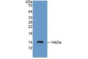 Detection of Recombinant PKIa, Human using Polyclonal Antibody to Protein Kinase Inhibitor Alpha (PKIa) (PKIA Antikörper  (AA 13-71))