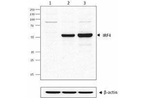 Western Blotting (WB) image for anti-Interferon Regulatory Factor 4 (IRF4) antibody (ABIN2665206) (IRF4 Antikörper)
