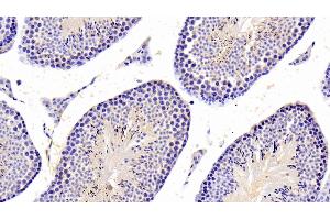Immunohistochemistry (IHC) image for anti-Protein tyrosine Phosphatase, Non-Receptor Type 5 (Striatum-Enriched) (PTPN5) (AA 270-533) antibody (ABIN7444961)