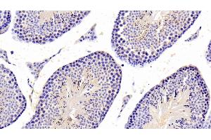 Detection of PTPN5 in Mouse Testis Tissue using Polyclonal Antibody to Protein Tyrosine Phosphatase, Non Receptor Type 5 (PTPN5) (PTPN5 Antikörper  (AA 270-533))