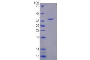 Image no. 1 for Arylsulfatase F (ARSF) (AA 23-300) (Active) protein (His tag) (ABIN6239870) (ARSF Protein (AA 23-300) (His tag))