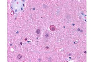 Anti-NPY5R antibody IHC of human brain, neurons and glia. (NPY5R Antikörper  (Cytoplasmic Domain))