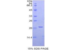 SDS-PAGE (SDS) image for Meningioma Expressed Antigen 5 (Hyaluronidase) (MGEA5) (AA 271-438) protein (His tag) (ABIN1877829)