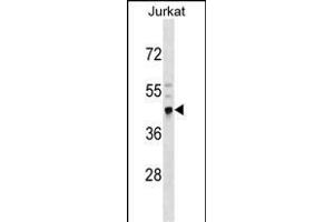 CRELD2 Antibody (N-term) (ABIN1539207 and ABIN2850367) western blot analysis in Jurkat cell line lysates (35 μg/lane). (CRELD2 Antikörper  (N-Term))