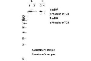 Western Blot (WB) analysis of lysis using Phospho-mTOR (S2448) antibody. (MTOR Antikörper  (pSer2448))