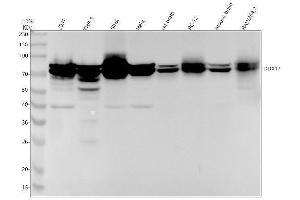 Western blot analysis of DDX17 using anti-DDX17 antibody (ABIN7604627).