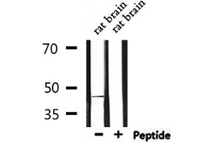 Western blot analysis of extracts from rat brain, using Beta Arrestin 2 Antibody. (Arrestin 3 Antikörper  (C-Term))