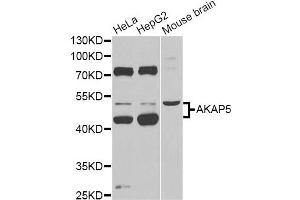 Western blot analysis of extracts of various cell lines, using AKAP5 Antibody (ABIN6291243) at 1:1000 dilution. (AKAP5 Antikörper)
