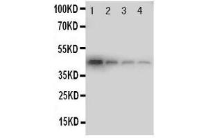 Lane 4: Recombinant Human DDR1 Protein 1. (DDR1 Antikörper  (C-Term))