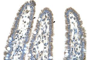CPS1 antibody was used for immunohistochemistry at a concentration of 4-8 ug/ml to stain Epithelial cells of intestinal villus (arrows) in Human Intestine.