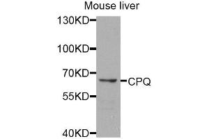 Western blot analysis of extracts of mouse liver, using CPQ antibody (ABIN5974910) at 1/1000 dilution. (CPQ Antikörper)