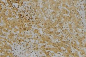 ABIN6272962 at 1/100 staining Mouse liver tissue by IHC-P. (KMO Antikörper  (Internal Region))