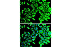 Immunofluorescence analysis of  cells using THADA antibody (ABIN6133115, ABIN6149103, ABIN6149104 and ABIN6222943). (THADA Antikörper  (AA 1684-1953))