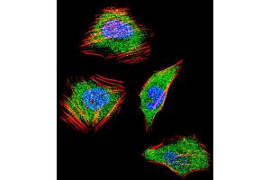 Fluorescent confocal image of Hela cell stained with SMAD4 Antibody . (SMAD4 Antikörper  (C-Term))