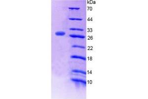 SDS-PAGE (SDS) image for Mediator Complex Subunit 1 (MED1) (AA 1-212) protein (His tag) (ABIN6239062)