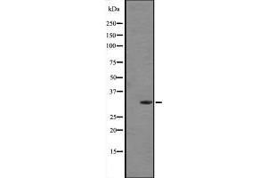 Western blot analysis of FGF5 expression in Human placenta tissue lysate (in RIPA buffer) ;,The lane on the left is treated with the antigen-specific peptide. (FGF5 Antikörper  (C-Term))
